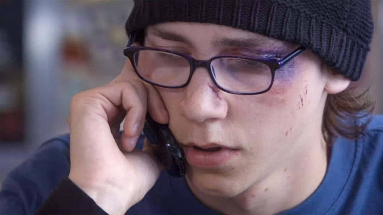 Skins 1. Sezon 5. Bölüm kapak